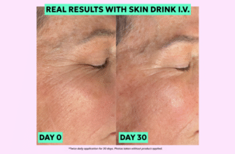 How I Did This: Plumping Skin Without Fillers