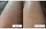 How to Get Smooth Legs by Giving Yourself a Leg Facial