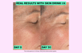 How I Did This: Plumping Skin Without Fillers
