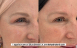 I Put My Skin to the Ultimate Dehydration Test. Here’s What Happened.